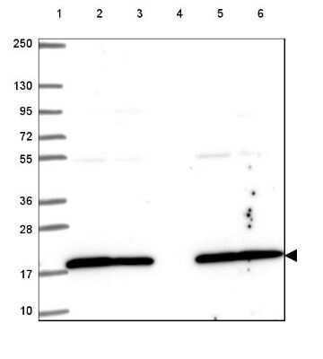 Western Blot: UbcH7/UBE2L3 Antibody [NBP2-49367]