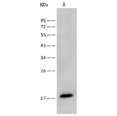 Western Blot: UbcH7/UBE2L3 Antibody [NBP2-99646]