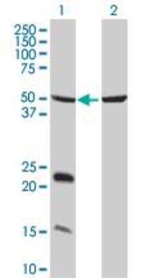 Western Blot: UbcH8/Ube2L6 Antibody (2F12-1F4) [H00009246-M01]
