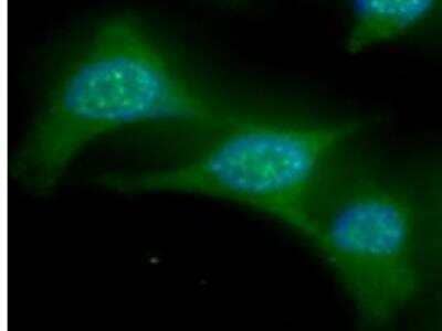 Immunocytochemistry/ Immunofluorescence: UbcH8/Ube2L6 Antibody (k1H3) - BSA Free [NBP1-04351]