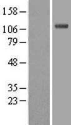 Western Blot: ISG15 Activating Enzyme/UBE1L Overexpression Lysate [NBL1-17502]