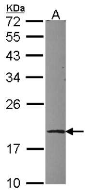 Western Blot: UBE2G1 Antibody [NBP2-20785]