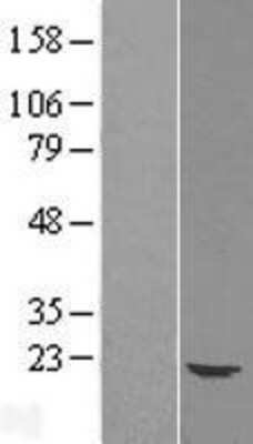 Western Blot: UBE2G1 Overexpression Lysate [NBL1-17528]