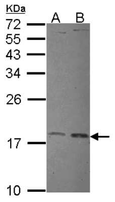 Western Blot: UbcH7/UBE2L3 Antibody [NBP2-20786]