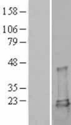 Western Blot: UbcH7/UBE2L3 Overexpression Lysate [NBL1-17537]