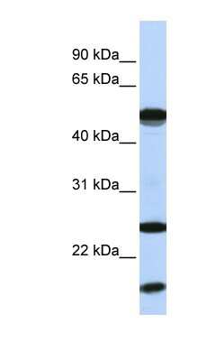 Western Blot: UbcH8/Ube2L6 Antibody [NBP1-55036]