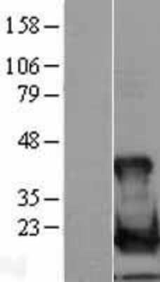 Western Blot: UbcH8/Ube2L6 Overexpression Lysate [NBL1-17538]