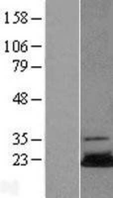 Western Blot: UBE2N/Ubc13 Overexpression Lysate [NBL1-17541]