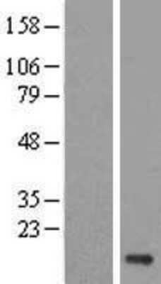 Western Blot: Uev1a/UBE2V1 Overexpression Lysate [NBL1-17547]