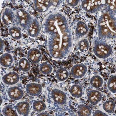 Immunohistochemistry-Paraffin: UBE2G2 Antibody [NBP1-86888]