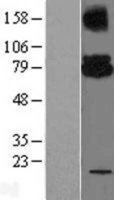 Western Blot: UBE2G2 Overexpression Lysate [NBL1-17529]