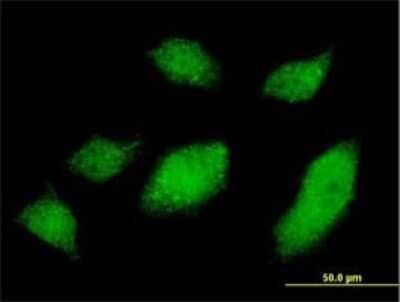 Immunocytochemistry/ Immunofluorescence: Ubiquilin 1 Antibody (1C6-A3) [H00029979-M01]