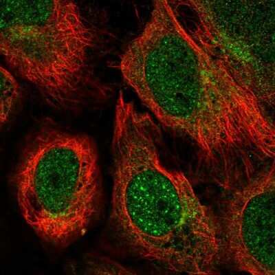 Immunocytochemistry/ Immunofluorescence: Ubiquilin 1 Antibody [NBP2-58403]