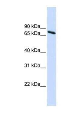 Western Blot: Ubiquilin 1 Antibody [NBP1-56536]