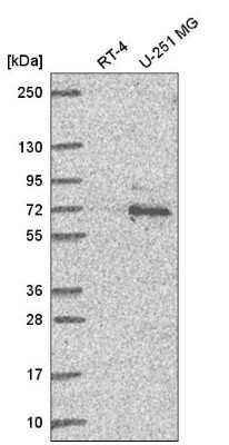 Western Blot: Ubiquilin 1 Antibody [NBP2-58403]