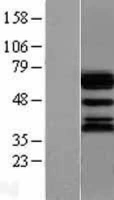 Western Blot: Ubiquilin 1 Overexpression Lysate [NBL1-17562]