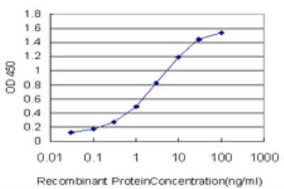 ELISA: Ubiquilin 2 Antibody (5F5) [H00029978-M03]