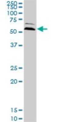 Western Blot: Ubiquilin 2 Antibody (5F5) [H00029978-M03]