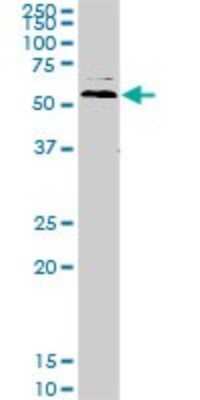 Western Blot: Ubiquilin 2 Antibody (5F5) [H00029978-M03]