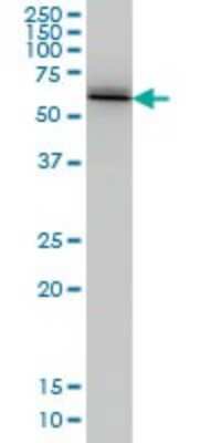 Western Blot: Ubiquilin 2 Antibody (5F5) [H00029978-M03]