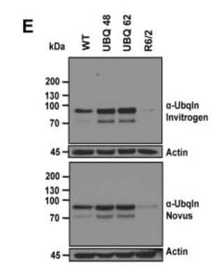 Western Blot: Ubiquilin 2 Antibody (5F5) [H00029978-M03]