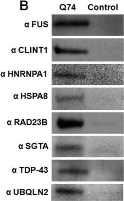 Western Blot: Ubiquilin 2 Antibody (5F5) [H00029978-M03]