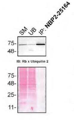 Immunoprecipitation: Ubiquilin 2 Antibody (6H9) [NBP2-25164]