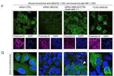 Knockdown Validated: Ubiquilin 2 Antibody (6H9) [NBP2-25164]