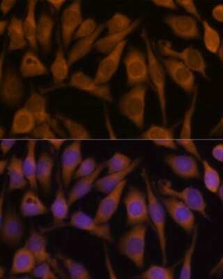 Immunocytochemistry/ Immunofluorescence: Ubiquilin 2 Antibody - BSA Free [NBP2-93303]