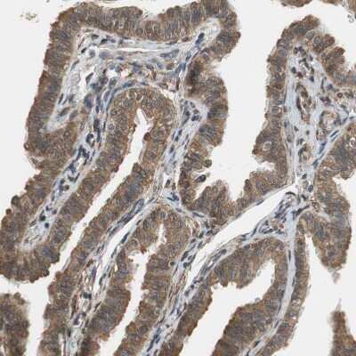 Immunohistochemistry-Paraffin: Ubiquilin 2 Antibody [NBP1-85639]