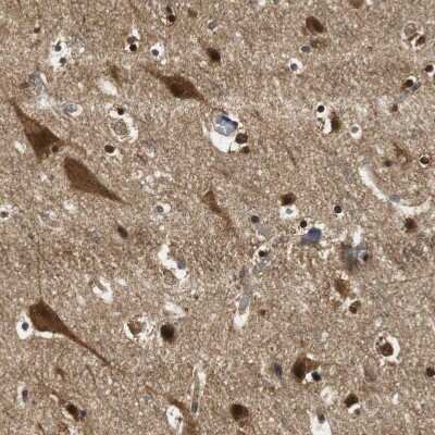 Immunohistochemistry-Paraffin: Ubiquilin 2 Antibody [NBP1-85639]