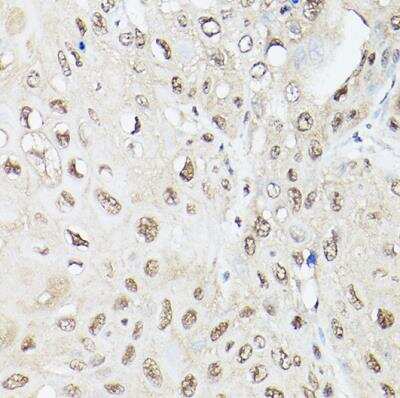 Immunohistochemistry-Paraffin: Ubiquilin 2 Antibody - BSA Free [NBP2-93303]