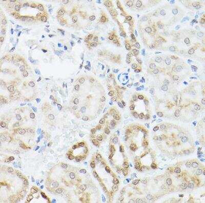 Immunohistochemistry-Paraffin: Ubiquilin 2 Antibody - BSA Free [NBP2-93303]