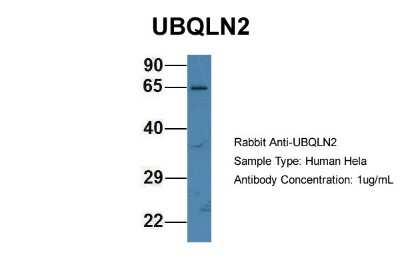 Western Blot: Ubiquilin 2 Antibody [NBP1-79753]