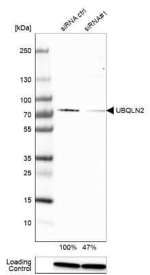 Western Blot: Ubiquilin 2 Antibody [NBP1-85639]