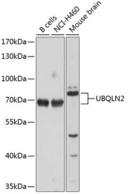 Western Blot: Ubiquilin 2 AntibodyBSA Free [NBP2-93303]