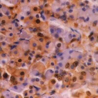 Immunohistochemistry-Paraffin: Ubiquitin Antibody (1B4-UB) - BSA Free [NB600-776]