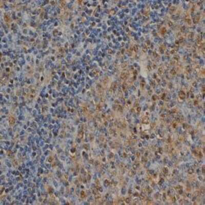 Immunohistochemistry-Paraffin: Ubiquitin Antibody (1B4-UB) - BSA Free [NB600-776]