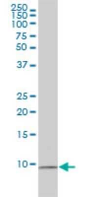 Western Blot: Ubiquitin Antibody (3E2-E6) [H00006233-M01]