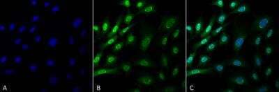 Immunocytochemistry/ Immunofluorescence: Ubiquitin Antibody (FK1) [NBP3-11039]