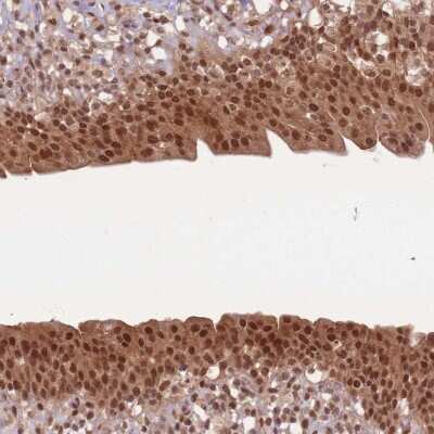 Immunohistochemistry-Paraffin: Ubiquitin B Antibody [NBP2-54736]