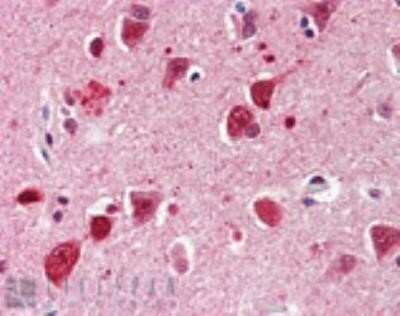 Immunohistochemistry: Ubiquitin Antibody (P4G7-H11) [NBP1-19306]