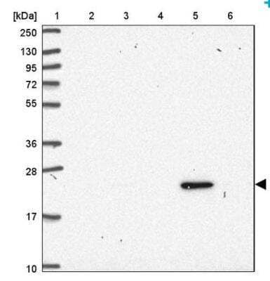 Western Blot: Ubiquitin B Antibody [NBP2-54736]