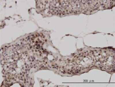Immunohistochemistry-Paraffin: Ubiquitin B Antibody (1F5) [H00007314-M01]