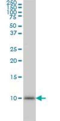 Western Blot: Ubiquitin B Antibody (1F5) [H00007314-M01]