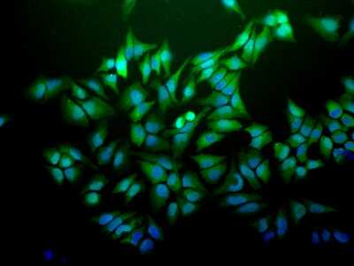 Immunocytochemistry/ Immunofluorescence: Ubiquitin B Antibody (6C11-B3) [NBP2-12882]