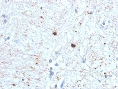 Immunohistochemistry-Paraffin: Ubiquitin B Antibody (UBB/1748) [NBP3-07163]