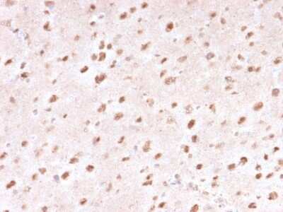 Immunohistochemistry-Paraffin: Ubiquitin B Antibody (UBB/1748) [NBP3-07163]