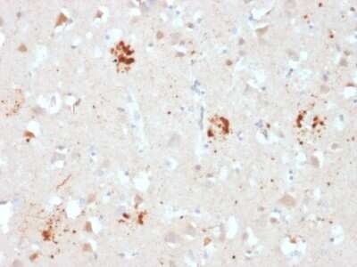 Immunohistochemistry-Paraffin: Ubiquitin B Antibody (UBB/2122) [NBP3-07164]