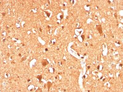 Immunohistochemistry-Paraffin: Ubiquitin B Antibody (UBB/3143R) - Azide and BSA Free [NBP3-08907]